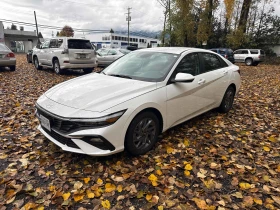 Hyundai Elantra * CARFAX * БЕЗ ПЪРВОНАЧАЛНА ВНОСКА - 41000 лв. / 20962.97 € - 19141218 2 | Car24.bg Hyundai Elantra * CARFAX * БЕЗ ПЪРВОНАЧАЛНА ВНОСКА - 41000 лв. / 20962.97 € - 19141218 2