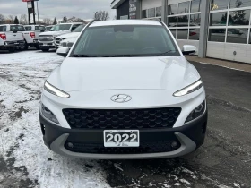 Hyundai Kona * Preferred * CARFAX * БЕЗ ПЪРВОНАЧАЛНА ВНОСКА - 17950 € / 35107.15 лв. - 94387989 2 | Car24.bg Hyundai Kona * Preferred * CARFAX * БЕЗ ПЪРВОНАЧАЛНА ВНОСКА - 17950 € / 35107.15 лв. - 94387989 2