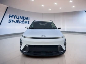 Hyundai Kona Preferred* ДИСТРОНИК* DIGITAL* КАМЕРА* ПОДГРЕВ* - 21400 € / 41854.76 лв. - 10213478 3 | Car24.bg Hyundai Kona Preferred* ДИСТРОНИК* DIGITAL* КАМЕРА* ПОДГРЕВ* - 21400 € / 41854.76 лв. - 10213478 3