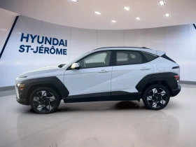 Hyundai Kona Preferred* ДИСТРОНИК* DIGITAL* КАМЕРА* ПОДГРЕВ* - 21400 € / 41854.76 лв. - 10213478 7 | Car24.bg Hyundai Kona Preferred* ДИСТРОНИК* DIGITAL* КАМЕРА* ПОДГРЕВ* - 21400 € / 41854.76 лв. - 10213478 7