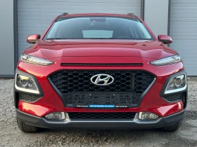 Hyundai Kona DIESEL* 159800KM* 6SPEED* EVRO6 - 21990 лв. - 27475348 | Car24.bg