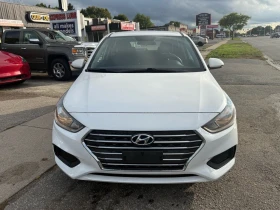 Hyundai Accent CARFAX * АвтоКредит* (ЦЕНА ДО БГ) - 21999 лв. / 11247.91 € - 18622674 3