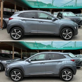 Hyundai Kona 1.6* 2WD*      | Mobile.bg    4