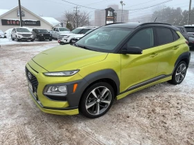 Hyundai Kona * Trend * CARFAX * БЕЗ ПЪРВОНАЧАЛНА ВНОСКА