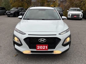 Hyundai Kona CARFAX* АВТОФИНАНСИРАНЕ* БЕЗ ПЪРВОНАЧАЛНА ВНОСКА*  - 16500 € / 32271.19 лв. - 93246470 6